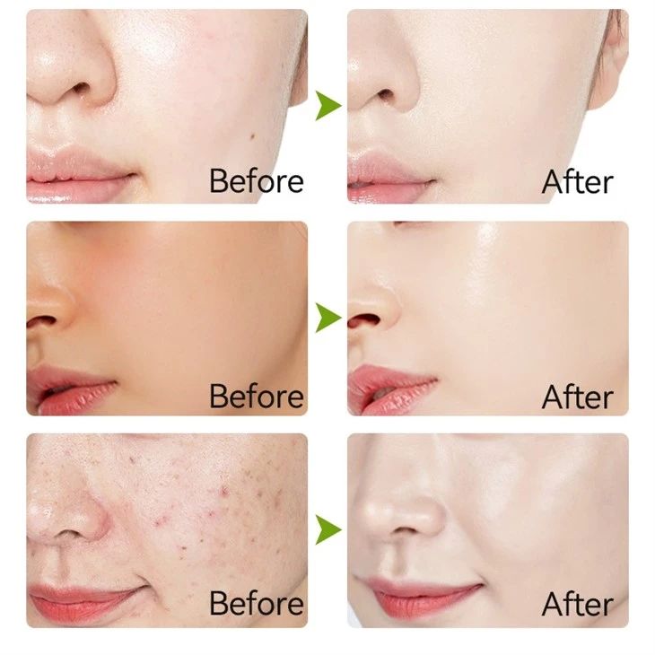 MOOYAM BUBBLE FACE MASK